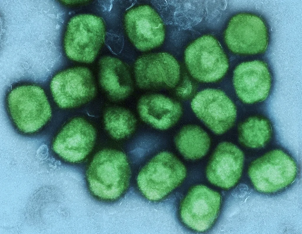WHO declares mpox a global emergency again as new strain spreads — World